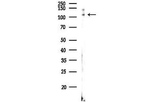 anti-KIAA1522 (KIAA1522) antibody