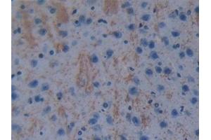 Detection of GSTt1 in Mouse Cerebrum Tissue using Polyclonal Antibody to Glutathione S Transferase Theta 1 (GSTt1) (GSTT1 antibody  (AA 7-240))