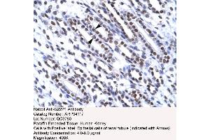 Immunohistochemistry (IHC) image for anti-X-Ray Repair Complementing Defective Repair in Chinese Hamster Cells 6 (XRCC6) (N-Term) antibody (ABIN2778270)