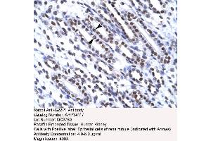 Human kidney (XRCC6 antibody  (N-Term))