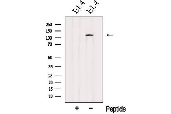 CARD10 antibody  (N-Term)