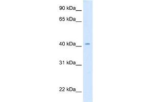 WB Suggested Anti-cad Antibody Titration:  0. (CAD antibody  (Middle Region))