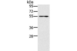 Western Blot analysis of Mouse intestinum tenue tissue using PUS10 Polyclonal Antibody at dilution of 1:200