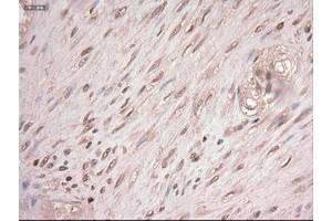 Image no. 8 for anti-Myc Proto-Oncogene protein (MYC) antibody (ABIN1497011) (c-MYC antibody)