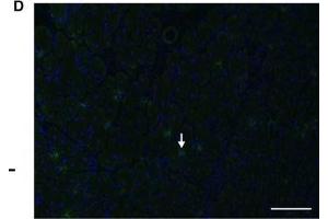 (A) T cells (CD3+ cells) were increased at 2 and 7 days postinjury (DPI) compared to 14 DPI (*, P < 0.