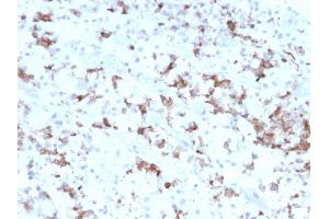 Formalin-fixed, paraffin-embedded human Pituitary stained with Prolactin Mouse Monoclonal Antibody (PRL/2641).