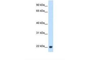 Image no. 1 for anti-Kallikrein B, Plasma (Fletcher Factor) 1 (KLKB1) (AA 429-478) antibody (ABIN320970) (KLKB1 antibody  (AA 429-478))