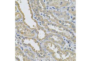 Immunohistochemistry of paraffin-embedded human kidney using PPID Antibody (ABIN5974177) at dilution of 1/100 (40x lens). (PPID antibody)
