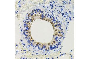 Immunohistochemistry of paraffin-embedded mouse lung using CALB2 antibody. (Calretinin antibody)