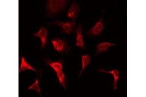Immunofluorescence (fixed cells) (IF/ICC) image for anti-Fibroblast Growth Factor Receptor 1 (FGFR1) (C-Term) antibody (ABIN6261731)