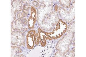 ABIN6266891 at 1/100 staining human kidney tissue sections by IHC-P.