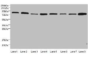 Western blot All lanes: Protein argonaute-2 antibody at 2 μg/mL Lane 1: A549 whole cell lysate Lane 2: Jurkats whole cell lysate Lane 3: MCF-7 whole cell lysate Lane 4: HepG2 whole cell lysate Lane 5: Raw264. (AGO2 antibody  (AA 517-818))
