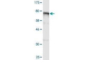 Western Blot detection against Immunogen (98. (ALOX15 antibody  (AA 1-662))