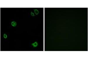 Immunofluorescence analysis of A549 cells, using GPR110 Antibody. (G Protein-Coupled Receptor 110 antibody  (AA 831-880))