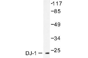 Image no. 1 for anti-Parkinson Protein 7 (PARK7) antibody (ABIN265384) (PARK7/DJ1 antibody)