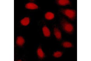ABIN6269077 staining Hela cells by ICC/IF. (c-MYC antibody  (N-Term))