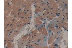 Detection of MAP1A in Mouse Heart Tissue using Polyclonal Antibody to Microtubule Associated Protein 1A (MAP1A)