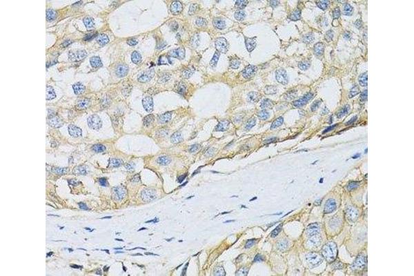 SLC3A2 antibody