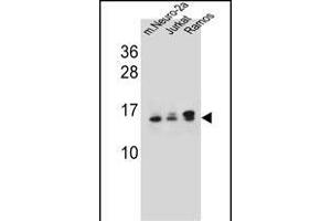 UBE2E2 Antibody (N-term) (ABIN657745 and ABIN2846729) western blot analysis in mouse Neuro-2a,Jurkat,Ramos cell line lysates (35 μg/lane). (UBE2E2 antibody  (N-Term))