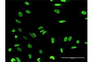 Immunofluorescence of purified MaxPab antibody to HN1L on HeLa cell. (HN1L antibody  (AA 1-190))