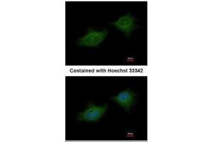ICC/IF Image Immunofluorescence analysis of methanol-fixed HeLa, using MMP3, antibody at 1:200 dilution. (MMP3 antibody)