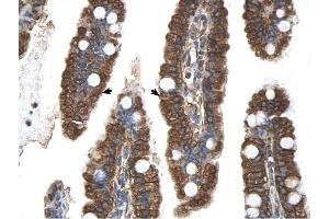 PGRMC1 antibody was used for immunohistochemistry at a concentration of 4-8 ug/ml to stain EpitheliaI cells of intestinal villus (arrows) in Human Intestine. (PGRMC1 antibody  (N-Term))