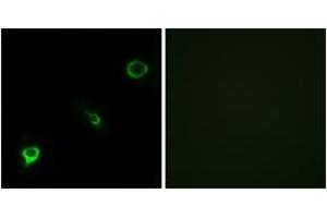 Immunofluorescence analysis of COS7 cells, using TYK2 (Ab-1054) Antibody. (TYK2 antibody  (AA 1020-1069))