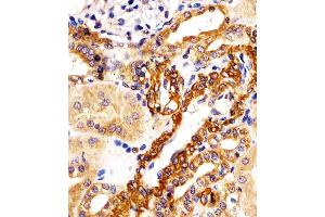 (ABIN6242941 and ABIN6578201) staining KIF22 in human kidney tissue sections by Immunohistochemistry (IHC-P - paraformaldehyde-fixed, paraffin-embedded sections). (KIF22 antibody  (AA 423-456))