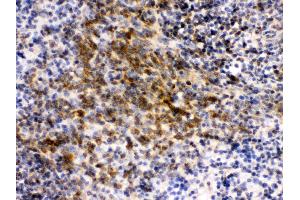Anti- eIF4A2 Picoband antibody, IHC(P) IHC(P): Mouse Spleen Tissue (EIF4A2 antibody  (N-Term))