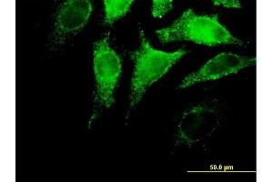 Immunofluorescence of purified MaxPab antibody to IFNA4 on HeLa cell. (IFNA4 antibody  (AA 1-189))