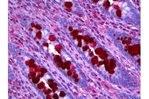 Anti-CLCA1 antibody IHC of human colon, goblet cells. (CLCA1 antibody)