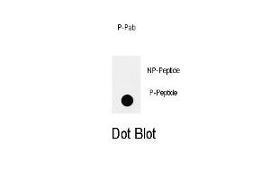 Dot blot analysis of anti-Phospho-IRS2-p Antibody (ABIN389979 and ABIN2839769) on nitrocellulose membrane. (IRS2 antibody  (pTyr978))