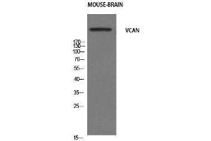 Western Blotting (WB) image for anti-Versican (Vcan) (N-Term) antibody (ABIN3177919) (Versican antibody  (N-Term))