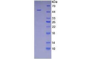 SDS-PAGE of Protein Standard from the Kit (Highly purified E. (ICAM1 CLIA Kit)