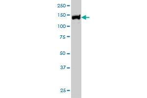 UBE4B monoclonal antibody (M01), clone 8F9 Western Blot analysis of UBE4B expression in Hela S3 NE . (UBE4B antibody  (AA 1075-1173))