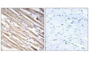 Immunohistochemistry analysis of paraffin-embedded human heart tissue using RPL3L antibody. (RPL3L antibody)