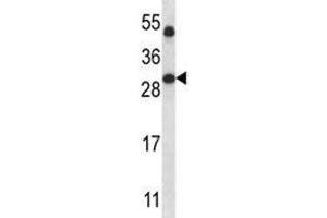 SIRT5 antibody western blot analysis in human placenta tissue lysate. (SIRT5 antibody  (AA 99-127))
