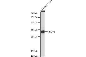 Western blot analysis of extracts of Mouse brain, using PROP1 Rabbit pAb (ABIN7269568) at 1:1000 dilution. (PROP1 antibody  (AA 50-150))
