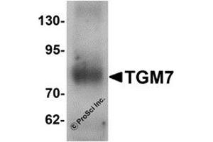 Western Blotting (WB) image for anti-Transglutaminase 7 (TGM7) antibody (ABIN1077363) (Transglutaminase 7 antibody)