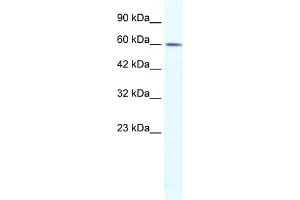 WB Suggested Anti-TRIM3 Antibody Titration:  1. (TRIM3 antibody  (N-Term))