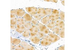 Immunohistochemistry of paraffin embedded mouse skeletal muscle using ATP2A2 (ABIN7075545) at dilution of 1: 500 (400x lens) (SERCA2 ATPase antibody)