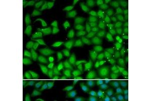 Immunofluorescence analysis of MCF-7 cells using RTKN Polyclonal Antibody (Rhotekin antibody)