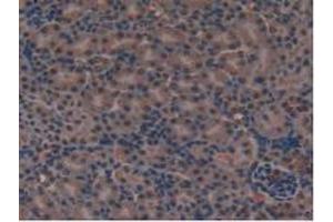 IHC-P analysis of Mouse Kidney Tissue, with DAB staining. (FLT4 antibody  (AA 30-326))