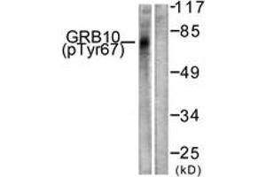 Western blot analysis of extracts from NIH-3T3 cells treated with Insulin 0. (GRB10 antibody  (pTyr67))