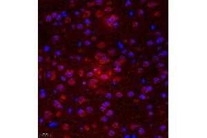 Immunofluorescence of paraffin embedded mouse brain using UTS2 (ABIN7076162) at dilution of 1:2000 (400x lens) (Urotensin 2 antibody)