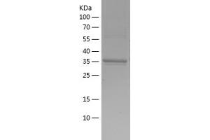 Western Blotting (WB) image for Growth Differentiation Factor 3 (GDF3) (AA 251-364) protein (His-IF2DI Tag) (ABIN7281869) (GDF3 Protein (AA 251-364) (His-IF2DI Tag))