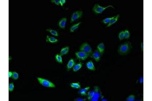 Immunofluorescent analysis of HepG2 cells using ABIN7163325 at dilution of 1:100 and Alexa Fluor 488-congugated AffiniPure Goat Anti-Rabbit IgG(H+L) (ABHD3 antibody  (AA 52-309))