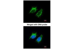 ICC/IF Image Immunofluorescence analysis of paraformaldehyde-fixed HeLa, using Inhibin beta-A , antibody at 1:200 dilution. (INHBA antibody  (C-Term))