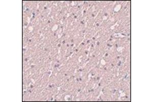 Immunohistochemistry of SIPA1L3 in human brain tissue with this product at 5 μg/ml. (SIPA1L3 antibody  (N-Term))