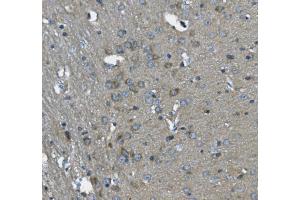 IHC analysis of SCG10/STMN2 using anti-SCG10/STMN2 antibody (ABIN7600734). (STMN2 antibody  (AA 23-170))